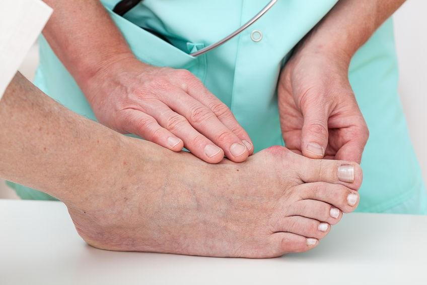 Battling Bunions Foot & Ankle Specialists of Central PA