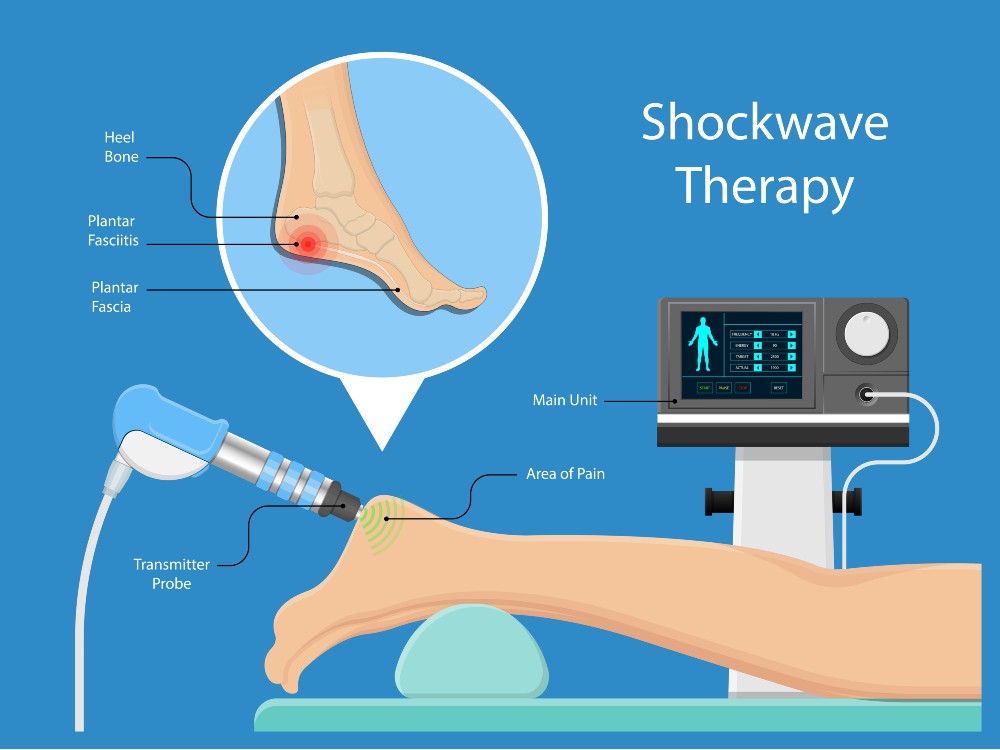 EPAT shockwave therapy explained