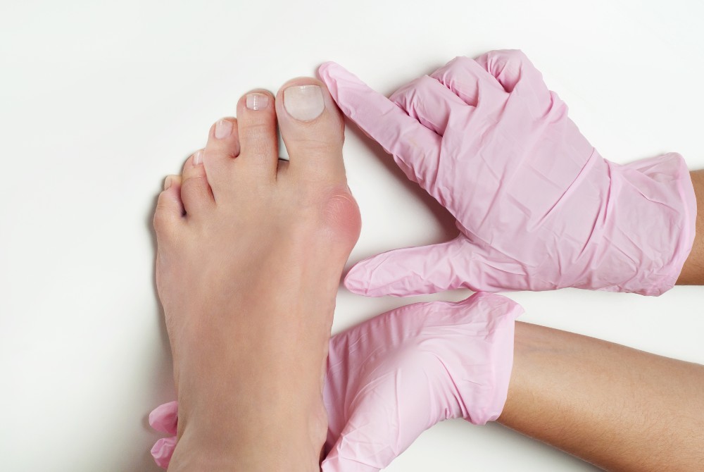 Podiatrist examining foot with bunion for 3D bunion correction procedure