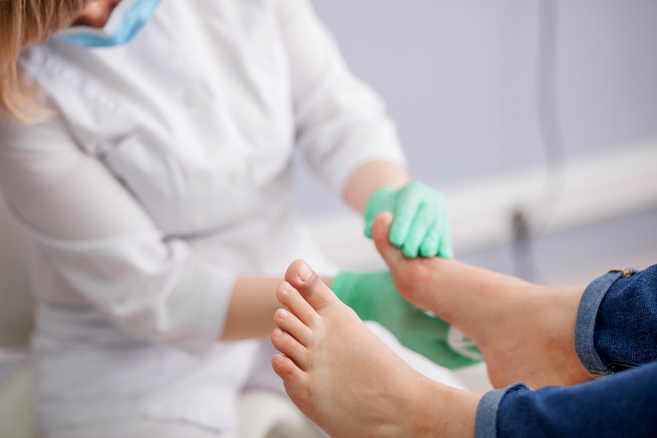 inspecting feet for diabetic wounds 
