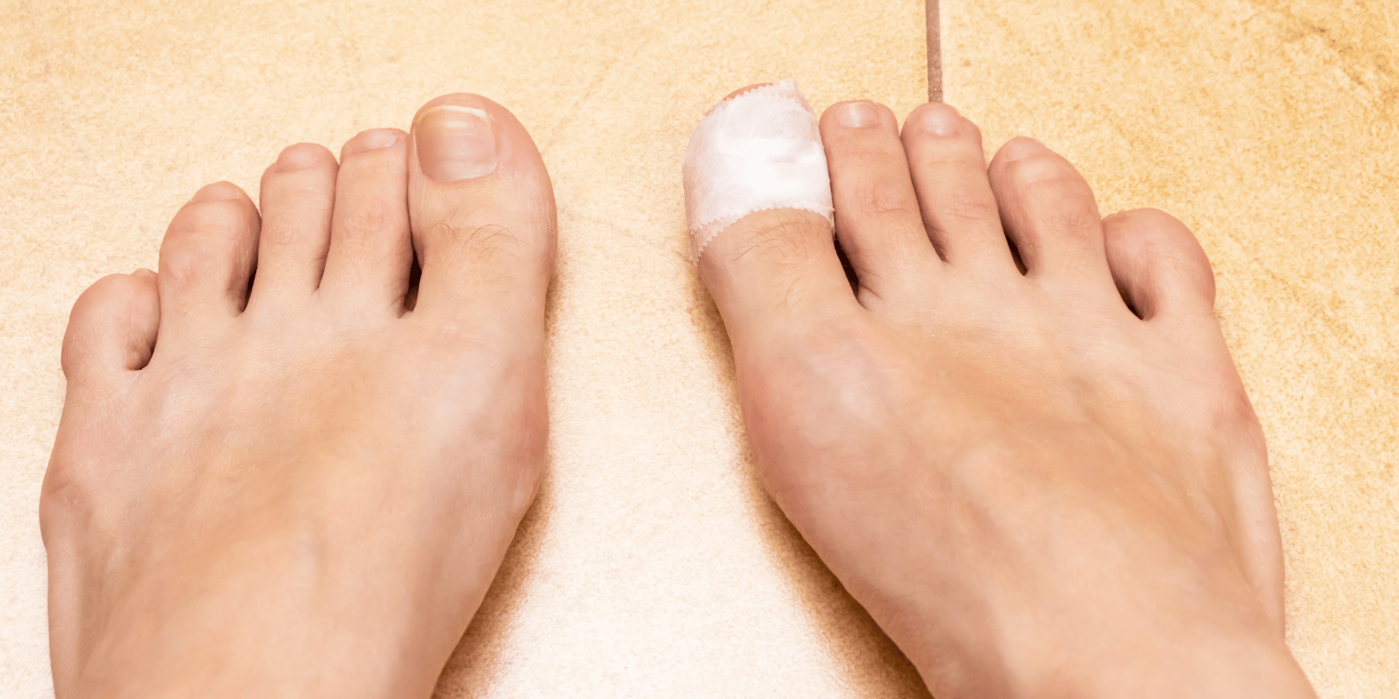 Woman's bare foot with a bandage on a toe. Wounded toe first aid